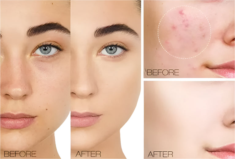 Creme QIC Corretivo Facial