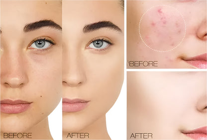 Creme QIC Corretivo Facial